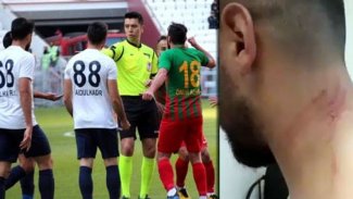 Amedspor PFDK'ya sevk edildi