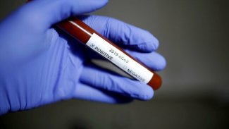 Optimar'dan koronavirüs anketi