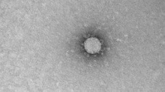 Rus bilim insanları koronavirüsün ilk mikroskop görüntülerini çekti