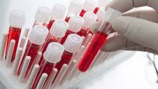 ABD Gıda ve İlaç Dairesi Koronavirüsün kan nakli yoluyla tedavisine onay verdi