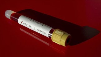 Belçika'da 12 yaşındaki kız çocuğu, Koronavirüs nedeniyle öldü