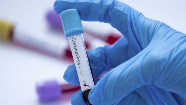 Koronavirüs testi pozitif çıkan kulüp doktoru intihar etti