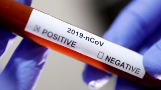 Koronavirüsten iyileşenlere kritik uyarı