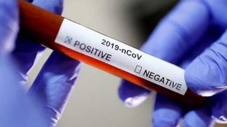  Kanada'da Kovid-19'a karşı özel bir diyaliz tedavisi geliştirildi