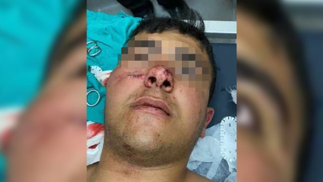 Van'da polis kurşunu bir çocuğu yaraladı