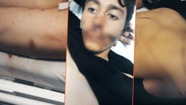 Hengaw: Van'da işkence edilen Kürt kolberlerden biri öldü