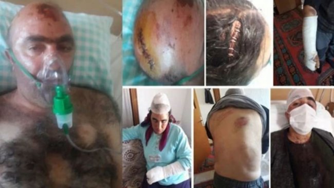 Irkçı saldırıya uğrayan Kürt aile yaşananları anlattı