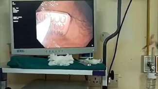 Cezaevi aramasında yakalanmamak için cep telefonu yuttu