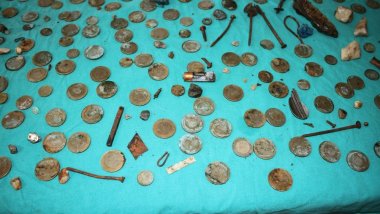 Van'da Psikolojik sorunları olan hastanın midesinden çıkanlar hayrete düşürdü!