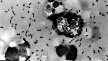 Milyonlarca can alan vebanın kökeni yaklaşık 700 yıl sonra tespit edildi