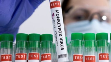 DSÖ maymun çiçeği için küresel acil durum ilan etti