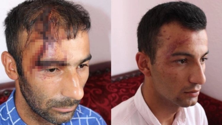 Aydın’da Kürt aileye ırkçı saldırı