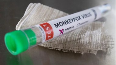 DSÖ'den kritik uyarı: Maymun çiçeği virüsü vakaları bini aştı