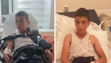 Bitlis'te kuduz köpek tarafından ısırılan çocuk hayatını kaybetti