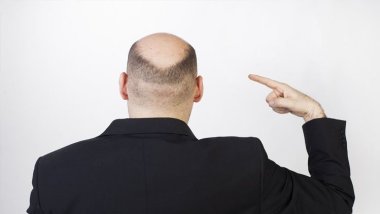 Kelliğin sırrı çözüldü… Tedavisi eski çağlara kadar uzanıyor