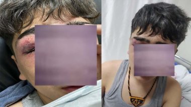 ‘İstiklal Marşı’ söylemeye zorlanan çocuk hastanelik edildi!