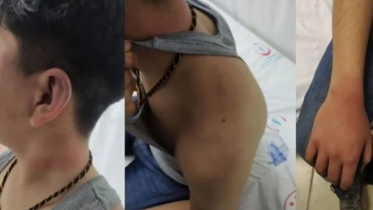 Diyarbakır'da 14 yaşındaki çocuğun darp edilmesiyle ilgili 3 polis hakkında tutuklama kararı