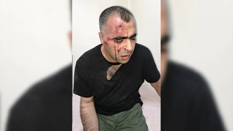 Gazeteci Sinan Aygül: Tatvan belediye başkanının korumalarının saldırısına uğradım