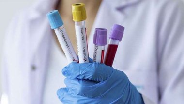 51 ülkede görüldü: Eris varyantının belirtileri neler?