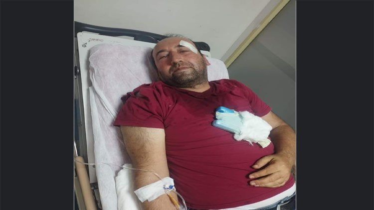 Viranşehirli Gazeteci davet edildiği programda darp edildi