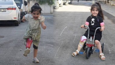 Esnaf birleşti, engelli doğan Arin ve Ayda kardeşlere protez bacak aldı