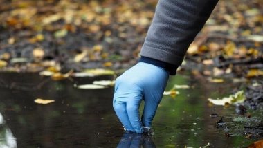 Başkent Erbil'de 221 kolera vakası kaydedildi