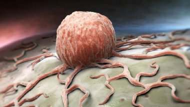 Kemoterapiye alternatif kanser tedavisi